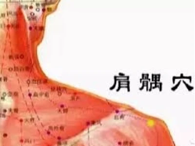 Huyệt Kiên Ngung: Vị Trí, Tác Dụng Và Cách Châm Cứu Hiệu Quả